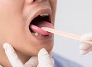 Medic examinând gâtul unui pacient cu ajutorul unui depresor lingual pentru a evalua starea amigdalelor