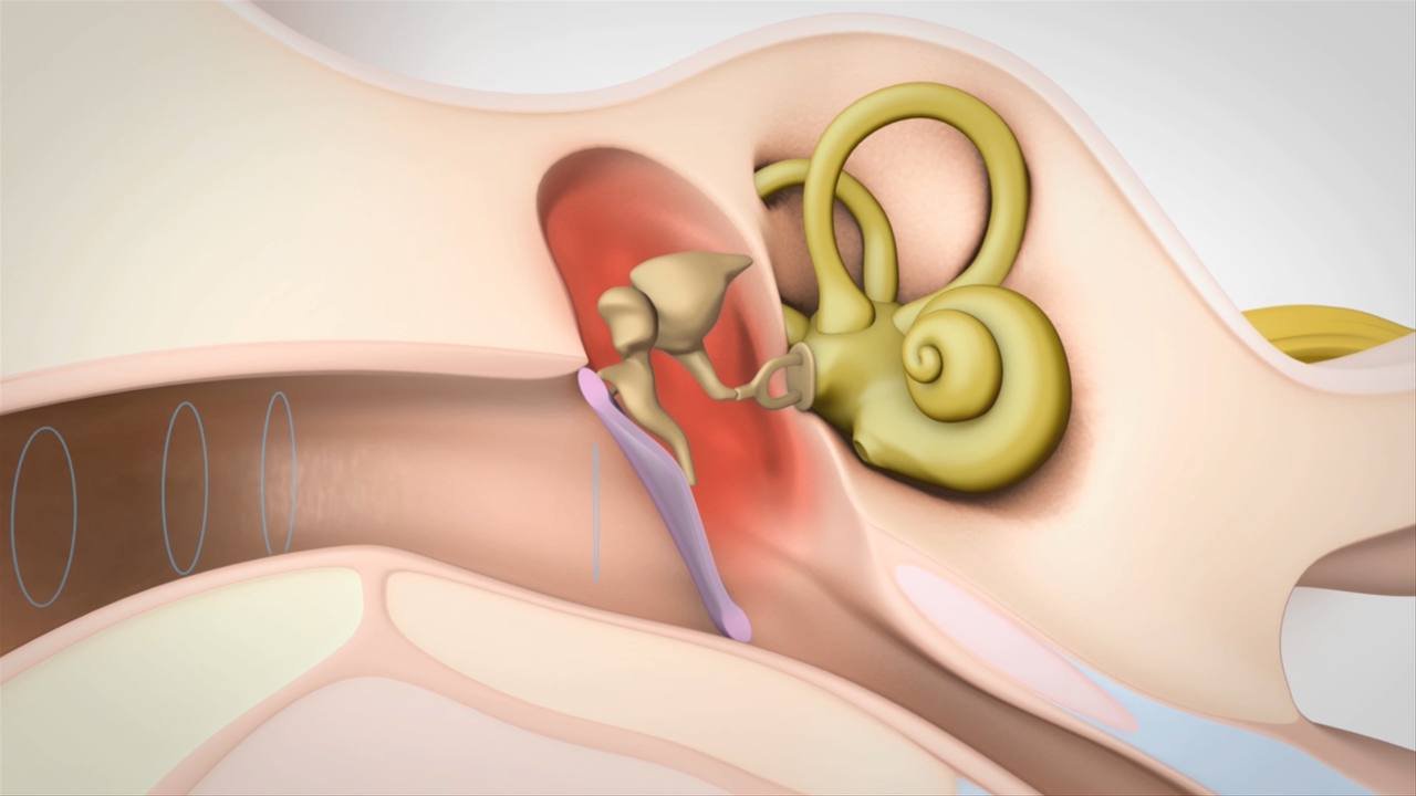 Clasificarea Hipoacuziei după Sediul Anatomic al Disfuncției