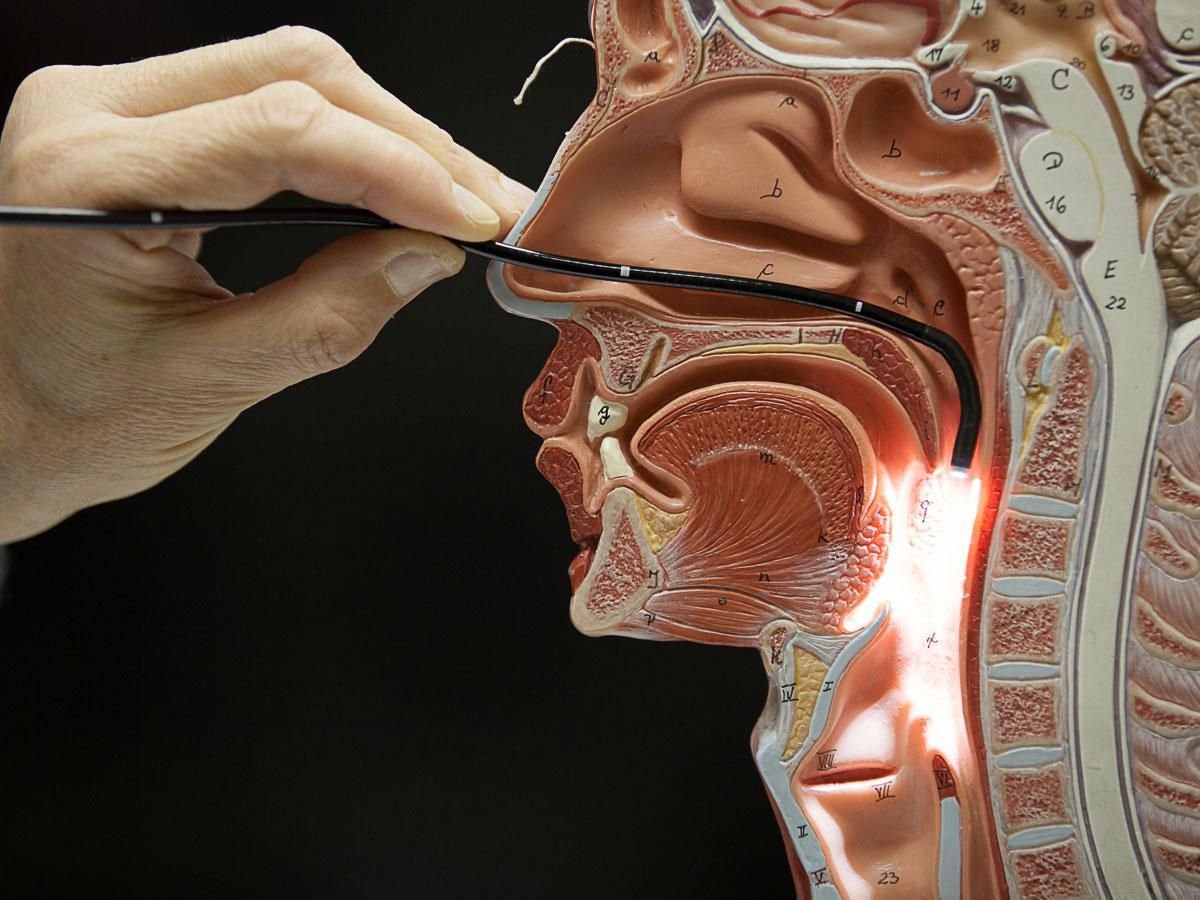Model anatomic cu traiectoria videofibroscopului prin nas, gât și laringe, evidențiind structurile examinate.